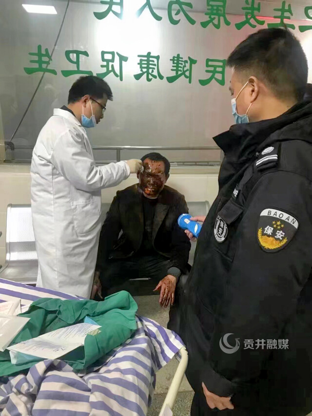 曹健救火受伤.JPG